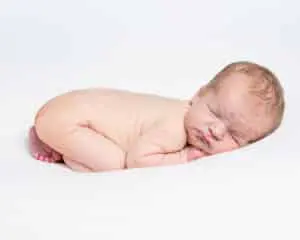 an unedited newborn portrait showing flaky skin