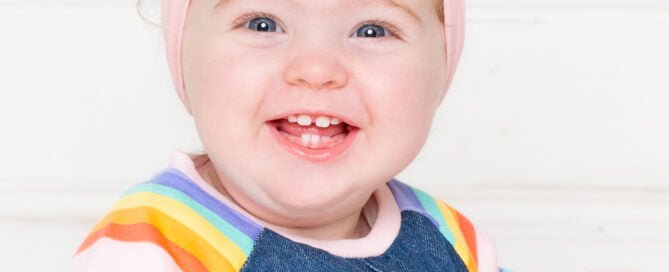 A baby in a denim and rainbow outfit with spots on their face