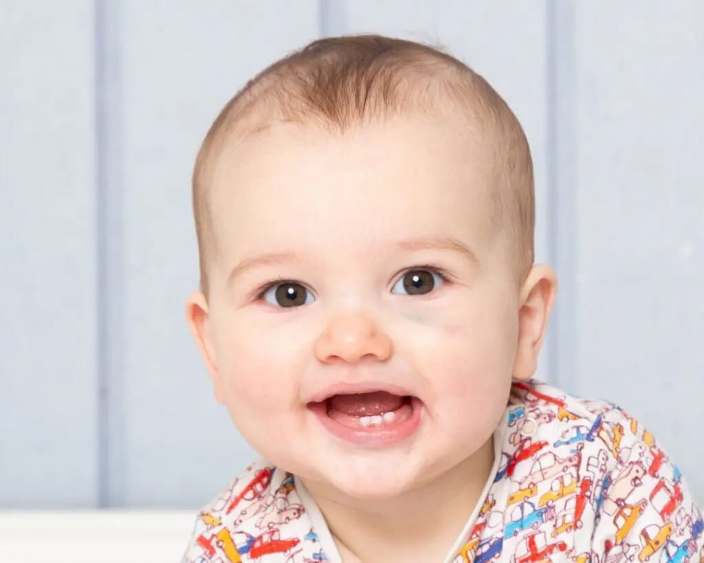a little boy with a black eye at a photo shoot