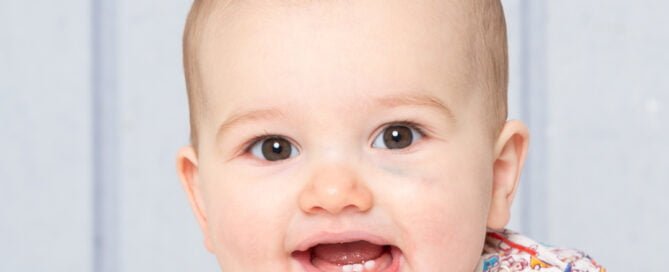 a little boy with a black eye at a photo shoot