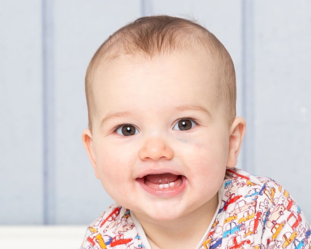 a little boy with a black eye at a photo shoot