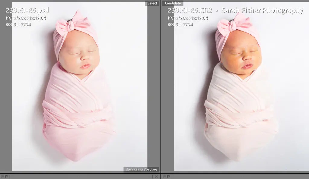 A before and after shot of a newborn with jaundice corrected