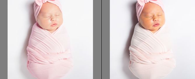 A before and after shot of a newborn with jaundice corrected